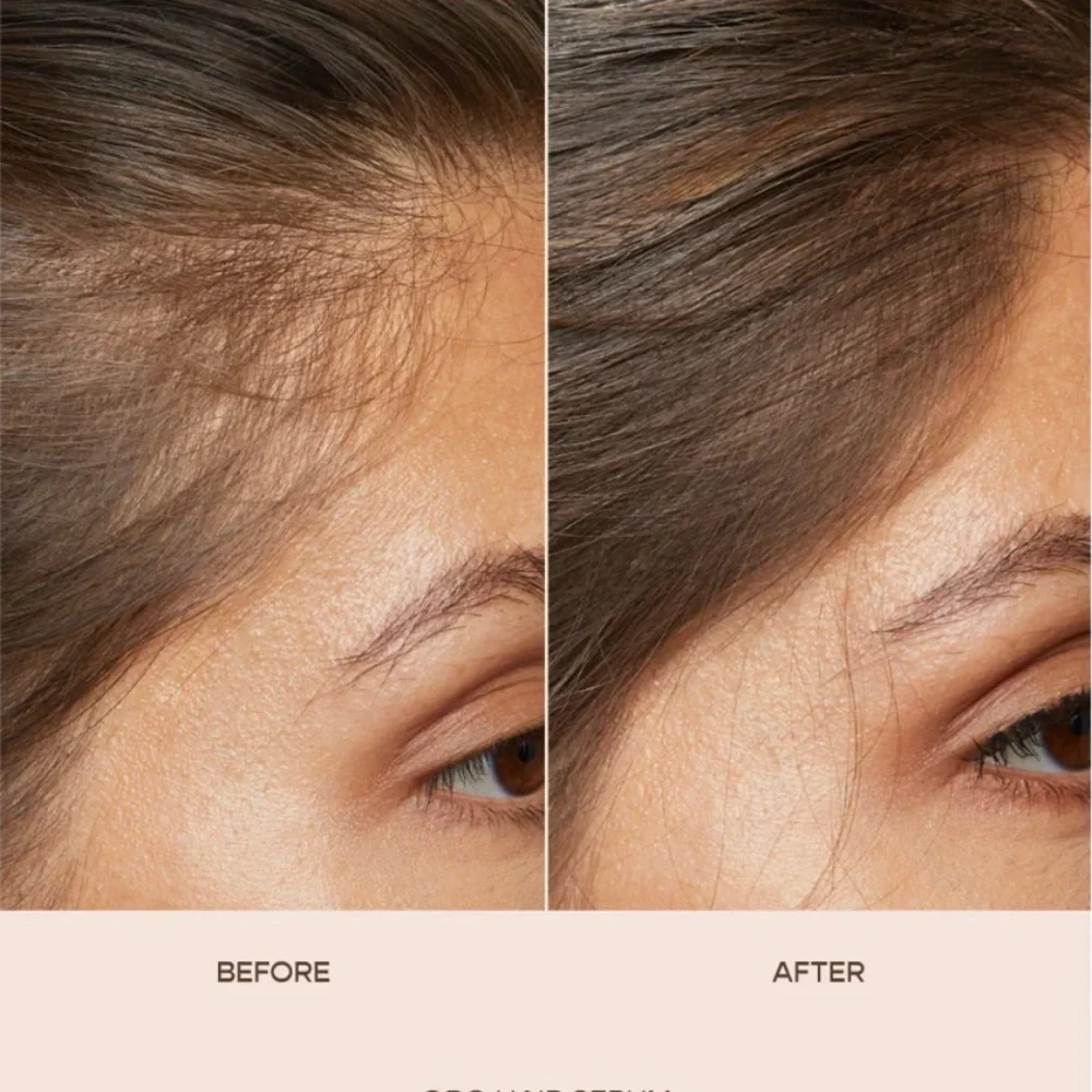 GRO Hair Serum - Pink - Picture 6 of 7